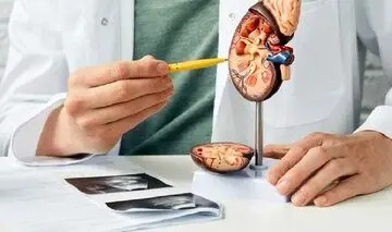 ارتباط بین سنگ کلیه و دیابت/ قند خون بالا باعث سنگ کلیه میشود؟