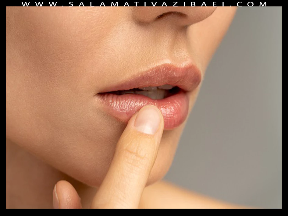 علل منگوله های پوستی روی لب