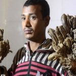 بیماری مرد درختی چیست؟ از علت تا درمان و جراحی (+عکس)