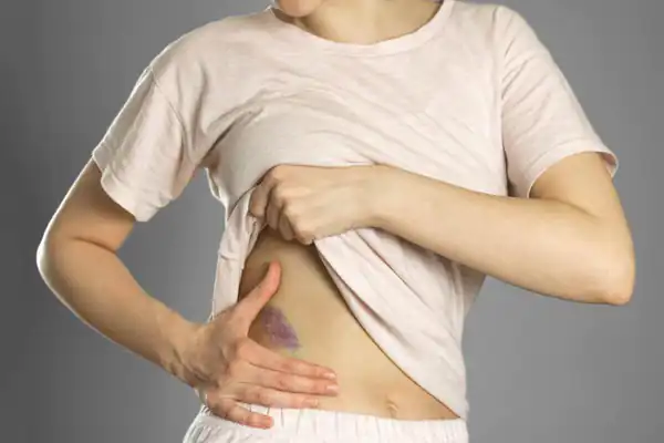 تعبیر خواب کبودی شکم برای زن متاهل و باردار و دختر مجرد از روانشناسی