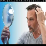 علل ریزش مو در شقیقه ها