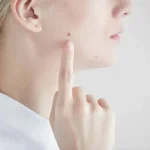 تعبیر خواب خال صورت برای زن متاهل و باردار و دختر مجرد از روانشناسی