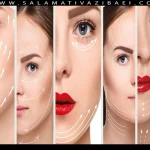 PDO Thread Lift چیست؟