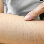 تعبیر خواب موی دست زن برای زن متاهل و باردار و دختر مجرد از روانشناسی