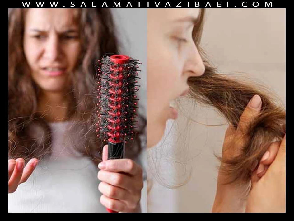 تفاوت ریزش مو طبیعی با ریزش بیش از حد مو