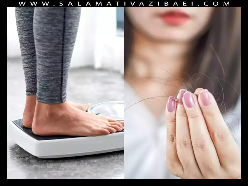 علل ارتباط ریزش مو و افزایش وزن در زنان