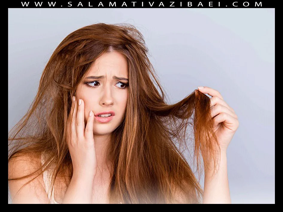 علل موهای کاهی