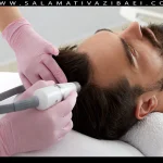 لیزر درمانی برای رشد مو