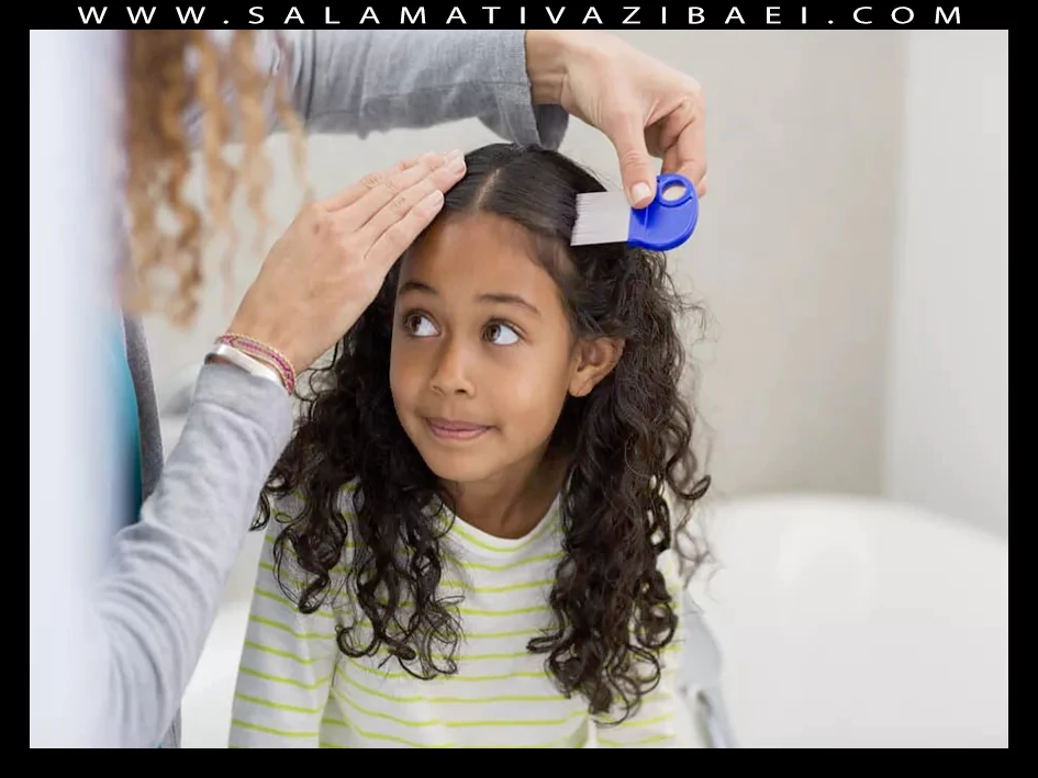 درمان خانگی سفیدی مو در کودکان