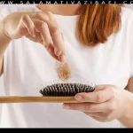 تستوسترون و ریزش مو