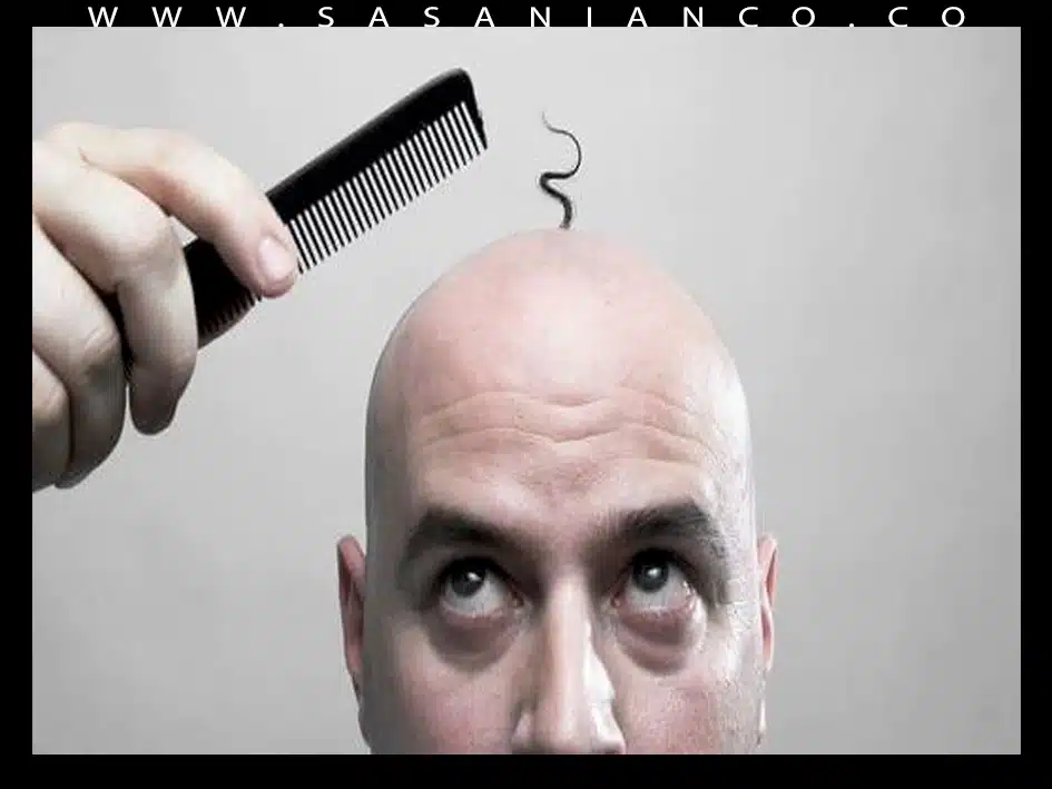 علل علمی ریزش مو در زنان و مردان